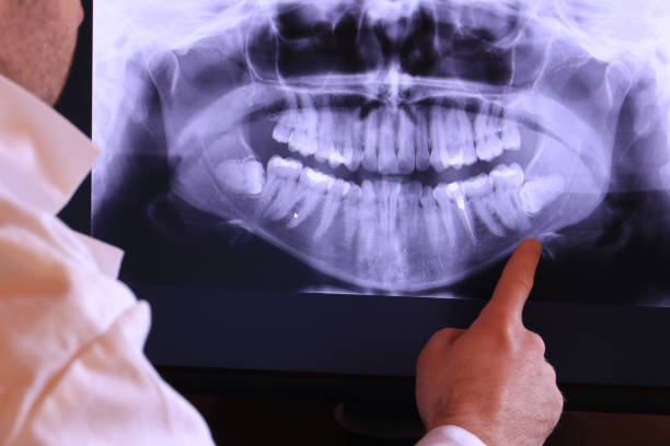 Best Emergency Dental Care for Broken or Chipped Teeth in Newport, KY